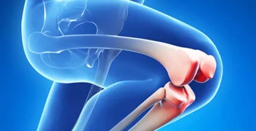 Total Knee Replacement  service image